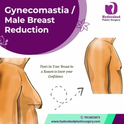 Best Gynecomastia Surgery in Hyderabad Surgery in Hyderabad