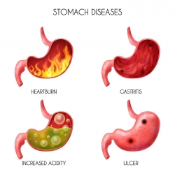 Laparoscopic cholecystectomy in Coimbatore