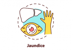 Jaundice Specialist Doctor in Coimbatore
