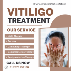 Vitiligo Hospital | Light Therapy for Vitiligo in Coimbatore